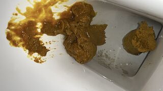 Soft shit to diarrhea pt1, ScatKings.com Scat Porn 12 ScatKings.com Scat Porn